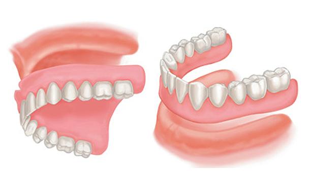 compete-dentures